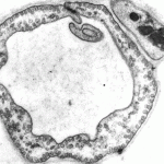 thin ndothelial cells line the circulatory system