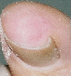 Pale circular pattern around an ear shaped reddish area